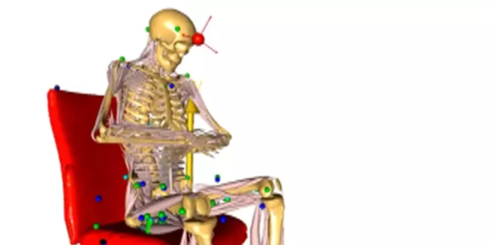 Eine technische Grafik demonstriert die Belastung der Wirbelsäule